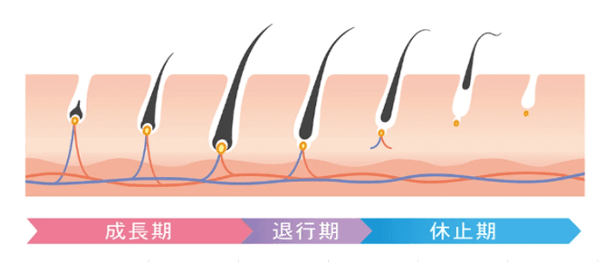毛周期（成長期・退行期・休止期）における毛と毛根の変化を示すイラスト